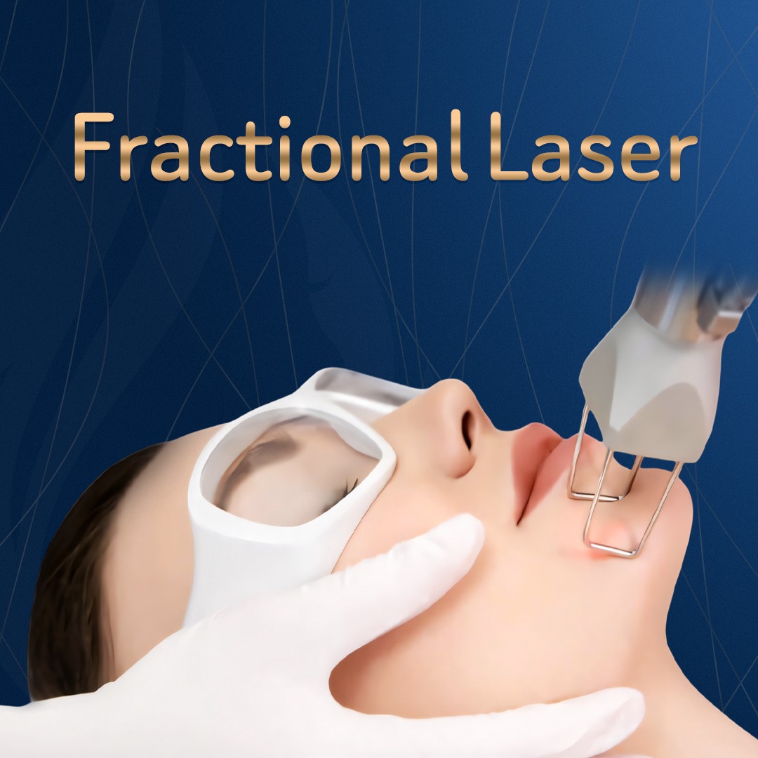 فراكشنال ليزر